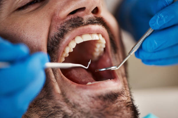 Best Broken or Chipped Tooth Repair in Shallotte, NC